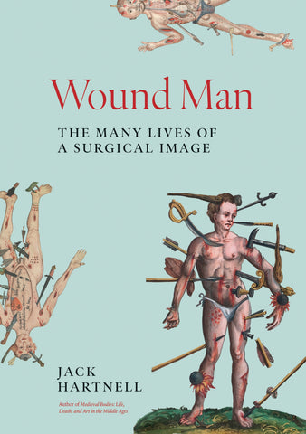 Wound Man : The Many Lives of a Surgical Image