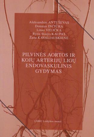 Pilvinės aortos ir kojų arterijų ligų endovaskulinis gydymas